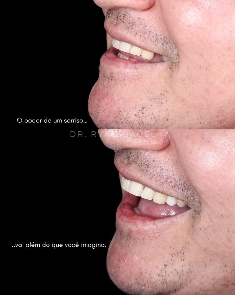 O poder de um sorriso - Dr. Ryan Gadelha